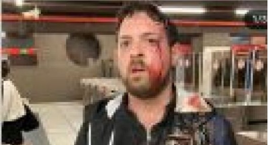 Milano – Filma borseggiatrici rom in Metro e viene aggredito: pugni e sberle, finisce all’ospedale