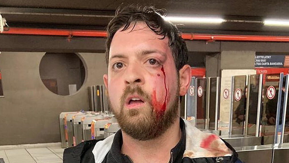 Borseggi a Milano – Arrestata la donna che ha aggredito Matthia Pezzoni: fermata (guarda caso) mentre derubava un’altra persona