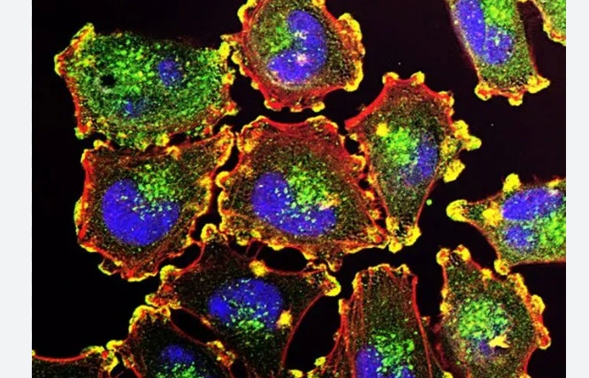 Lotta ai tumori – Arriva il nano computer fatto di proteine: riesce a cambiare posizione alle cellule