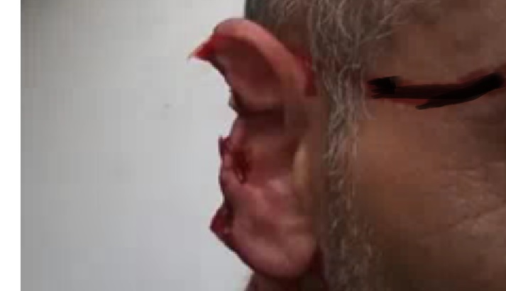 Follia in Lombardia – Passante guarda troppo sua moglie, nigeriano gli stacca un orecchio a morsi. Arrestato