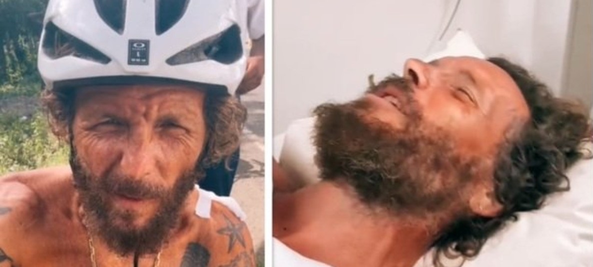 Jovanotti ‘vola’ dalla bicicletta. Disastroso incidente: “Rotti clavicola e femore”
