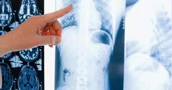 Lombardia – Radiologo fotografava le pazienti nude e le “aiutava” a spogliarsi: denunciato per violenza sessuale