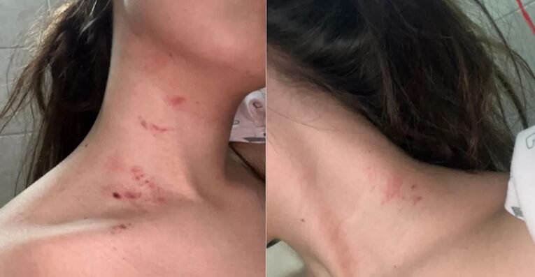 Milano: tenta di strozzare l’ex fidanzata perché lo ha mollato – La salva la coinquilina. Denunciato