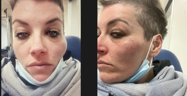 Milano: la cantante Laura Ciriaco rapinata fuori dal supermercato – “Massacrata di botte”