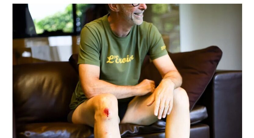 Milano – Linus “vola” in strada in Vespa: presa una buca, ferito a piede e ginocchio