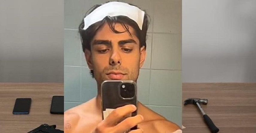 Orrore a Milano – Preso a martellate in testa per rubargli l’orologio. Il racconto agghiacciante di un ragazzo