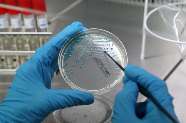 A Milano scoppia l’allarme legionella – 11 ricoverati e 1 morto. Il quartiere colpito