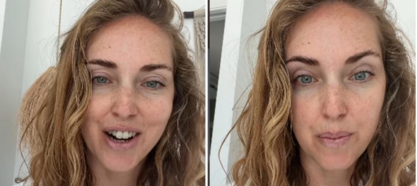 Milano – Ferragni e l’accusa dei follower: “Dici di accettarti come sei, allora perché fai il Botox?”. La risposta